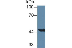 anti-Aminoadipate Aminotransferase (AADAT) (AA 99-425) antibody