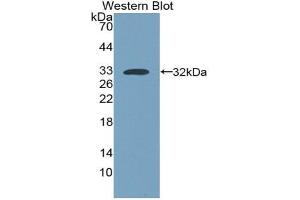 MYH7 Antibody (ABIN7268750)
