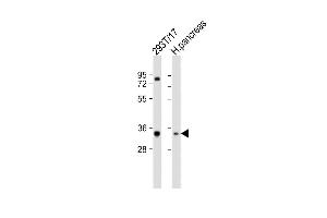 SHOX antibody  (N-Term)