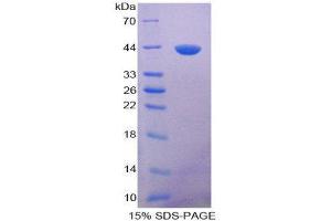 Image no. 1 for Brain Natriuretic Peptide (BNP) protein (His tag) (ABIN1098907)