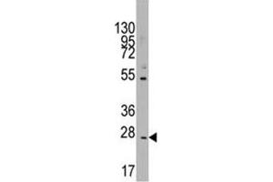 Image no. 2 for anti-CD8b Molecule (CD8B) (AA 64-92) antibody (ABIN3028556)