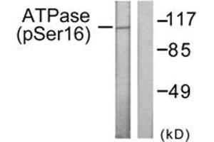 Western blot analysis of extracts from 293 cells treated with PMA 125ng/ml 30', using ATPase (Phospho-Ser16) Antibody.