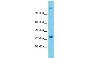 anti-Dynactin 5 (p25) (DCTN5) (N-Term) antibody