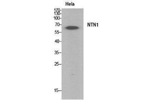 Image no. 3 for anti-Netrin 1 (NTN1) (Internal Region) antibody (ABIN3181063)