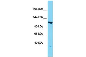 Image no. 1 for anti-TAF3 RNA Polymerase II, TATA Box Binding Protein (TBP)-Associated Factor, 140kDa (TAF3) (N-Term) antibody (ABIN2780183)