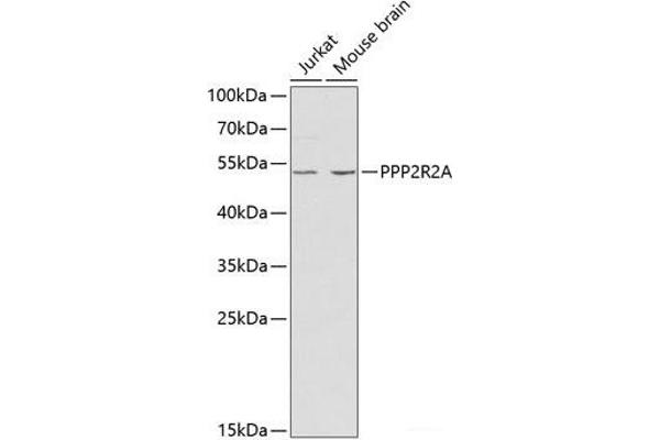 PPP2R2A Antikörper