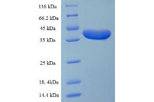 Image no. 1 for Desmoplakin (DSP) (AA 78-300), (partial) protein (His-SUMO Tag) (ABIN5709423)