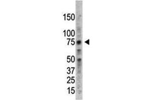 Image no. 3 for anti-Protein Arginine Methyltransferase 5 (PRMT5) (AA 591-621) antibody (ABIN3032362)