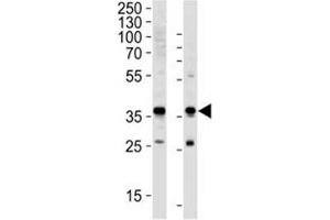 Image no. 6 for anti-Glyceraldehyde-3-Phosphate Dehydrogenase (GAPDH) (AA 62-91) antibody (ABIN3029800)