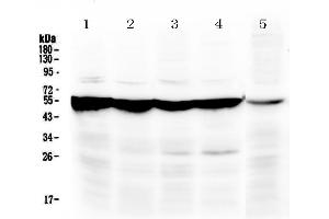 Image no. 4 for anti-Phenylalanine Hydroxylase (AA 71-208) antibody (ABIN5518942)