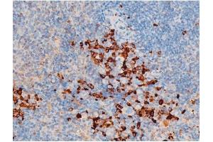 Image no. 11 for anti-Spleen tyrosine Kinase (SYK) (pTyr348) antibody (ABIN6255895)