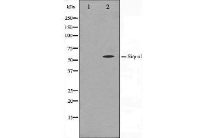Image no. 3 for anti-Signal-Regulatory Protein alpha (SIRPA) antibody (ABIN6265078)