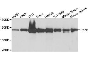 Image no. 1 for anti-Protein Kinase N1 (PKN1) antibody (ABIN6566611)