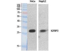 Image no. 1 for anti-Insulin-Like Growth Factor Binding Protein 3 (IGFBP3) (Internal Region) antibody (ABIN3187991)