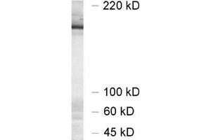 Image no. 2 for anti-Unc-13 Homolog A (UNC13A) (AA 3-317) antibody (ABIN1742278)