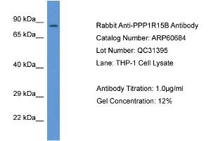 Image no. 1 for anti-Protein Phosphatase 1, Regulatory Subunit 15B (PPP1R15B) (C-Term) antibody (ABIN2774292)