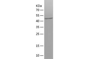 Western Blotting (WB) image for ATP-Binding Cassette, Sub-Family D (Ald), Member 1 (ABCD1) (AA 355-576) protein (His-IF2DI Tag) (ABIN7121932)