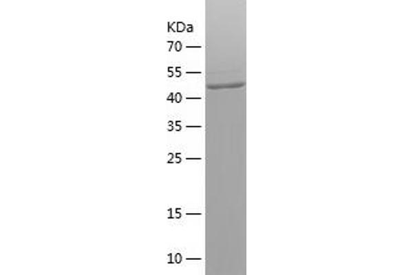 ABCD1 Protein (AA 355-576) (IF2DI tag)