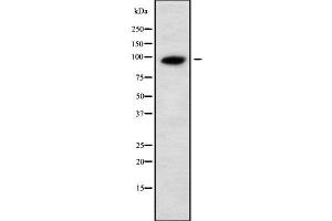Image no. 2 for anti-Unc-5 Homolog A (UNC5A) (Internal Region) antibody (ABIN6265895)