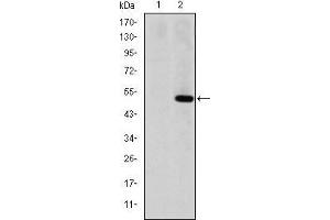 Image no. 2 for anti-Matrix Metallopeptidase 1 (Interstitial Collagenase) (MMP1) antibody (ABIN969287)