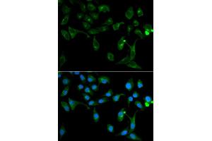 Image no. 3 for anti-Toll Interacting Protein (TOLLIP) antibody (ABIN3023652)