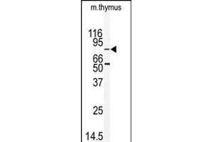 MARK2 antibody  (C-Term)