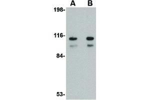 Image no. 3 for anti-Sphingosine-1-Phosphate Receptor 1 (S1PR1) (C-Term) antibody (ABIN6656697)