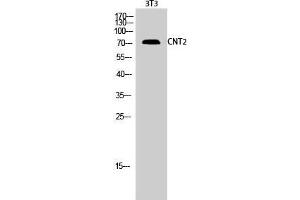 Image no. 2 for anti-Solute Carrier Family 28 (Sodium-Coupled Nucleoside Transporter), Member 2 (SLC28A2) (Internal Region) antibody (ABIN3183992)