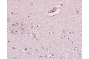 Image no. 3 for anti-Zinc Finger Protein 536 (ZNF536) (N-Term) antibody (ABIN6657215)