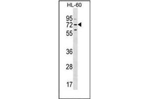 Image no. 3 for anti-Mbt Domain Containing 1 (MBTD1) (AA 571-600), (C-Term) antibody (ABIN953341)