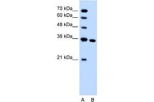 Image no. 1 for anti-Solute Carrier Family 25, Member 29 (SLC25A29) (C-Term) antibody (ABIN2781559)