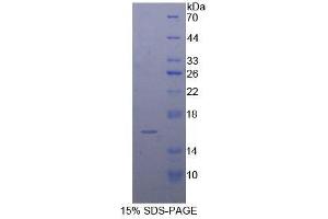 Image no. 1 for Filamin B, beta (FLNB) (AA 1175-1457) protein (His tag) (ABIN1877693)