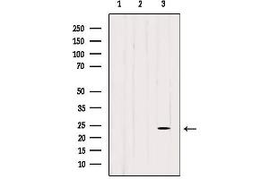 Image no. 1 for anti-CDC42 Effector Protein (Rho GTPase Binding) 3 (CDC42EP3) (Internal Region) antibody (ABIN6258453)