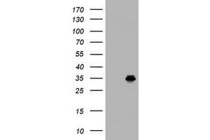 Image no. 1 for anti-Low Density Lipoprotein Receptor Adaptor Protein 1 (LDLRAP1) antibody (ABIN1496693)