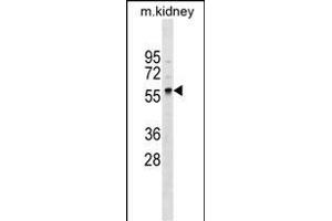 GLT11 Antibody (N-term) (ABIN1538962 and ABIN2849516) western blot analysis in mouse kidney tissue lysates (35 μg/lane).