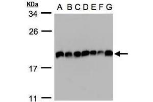 Image no. 3 for anti-Eukaryotic Translation Initiation Factor 5A2 (EIF5A2) (C-Term) antibody (ABIN2856761)
