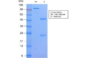 Image no. 1 for anti-Major Histocompatibility Complex, Class II, DP beta 1 (HLA-DPB1) antibody (ABIN6939630)
