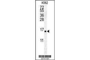 anti-Histone Cluster 2, H2aa4 (HIST2H2AA4) (AA 102-130), (C-Term) antibody