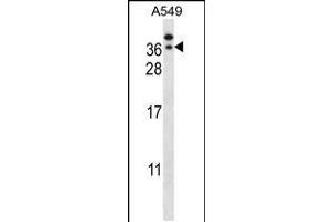 Image no. 2 for anti-General Transcription Factor IIE, Polypeptide 2 (GTF2E2) (AA 240-269), (C-Term) antibody (ABIN5533296)