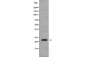 Image no. 3 for anti-Peptidylprolyl Isomerase F (PPIF) antibody (ABIN6258097)