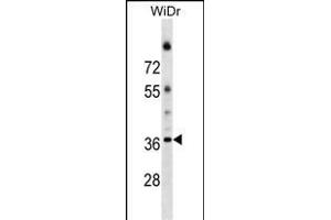 ALG5 Antibody (Center) (ABIN1538598 and ABIN2849400) western blot analysis in WiDr cell line lysates (35 μg/lane).
