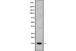 Image no. 1 for anti-NADH Dehydrogenase (Ubiquinone) Fe-S Protein 5, 15kDa (NADH-Coenzyme Q Reductase) (NDUFS5) (C-Term) antibody (ABIN6263573)