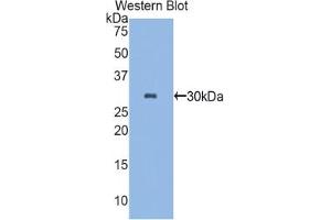 Image no. 1 for anti-Plastin 3 (PLS3) (AA 234-475) antibody (ABIN2920486)