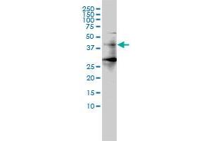Image no. 2 for anti-Histone Deacetylase 11 (HDAC11) (AA 1-347) antibody (ABIN566400)