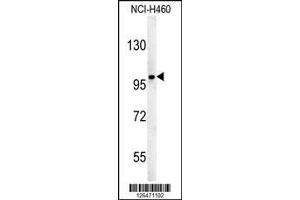Image no. 1 for anti-Zinc Finger Protein 387 (ZNF387) (AA 339-367), (N-Term) antibody (ABIN651571)