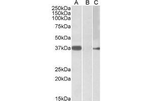 Image no. 1 for anti-Myogenic Factor 6 (MYF6) (Internal Region) antibody (ABIN571147)
