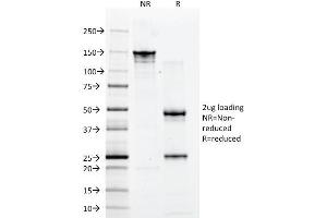Image no. 4 for anti-CD2 (CD2) antibody (ABIN6941011)