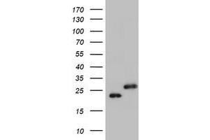 Image no. 1 for anti-Ubiquitin-Conjugating Enzyme E2E 3 (UBE2E3) antibody (ABIN1501628)