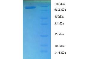 Image no. 1 for T-Box 18 (TBX18) (AA 1-607), (full length) protein (His-SUMO Tag) (ABIN5710464)