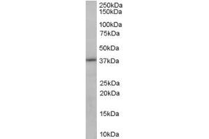 Image no. 3 for anti-Sorbitol Dehydrogenase (SORD) (C-Term) antibody (ABIN185332)